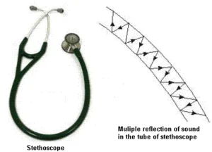 7 Powerful Uses and Laws of Reflection of Sound Waves You Should Know The stethoscope