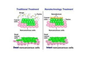 nanotechnology in cancer treatment