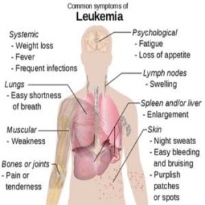 Leukemia