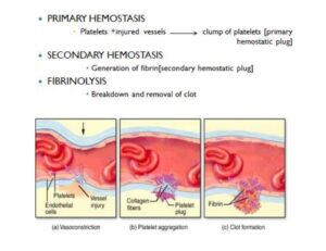 Steps of Hemostasis