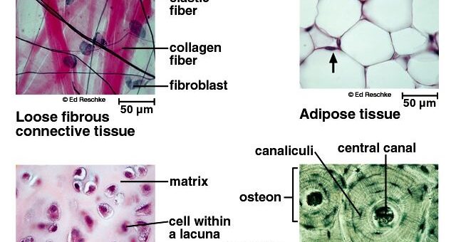 Classification of connective tissue