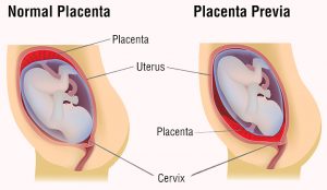 Placenta