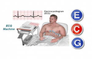 The electrocardiogram (ECG)