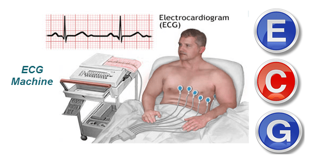 The electrocardiogram (ECG)