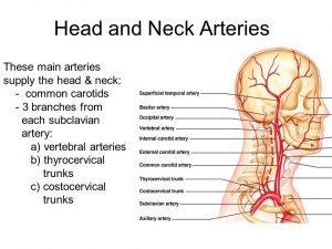 Arteries of head and neck 