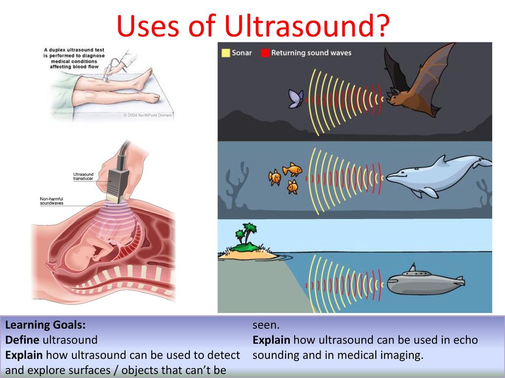 Sound intensity, Factors affecting Sound intensity & Applications of ultrasonic  waves | Science online