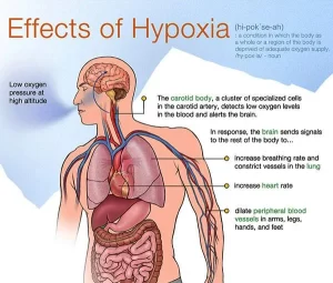 Hypoxia