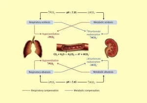 Acid-base disturbances, metabolic acidosis causes, Effects of acidosis and alkalosis on the body Acid-base disturbances