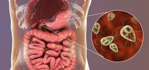 Diagnosis of parasitic infections