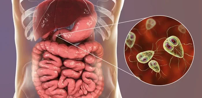 Diagnosis of parasitic infections