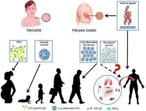 Life cycle of varicella zoster virus 