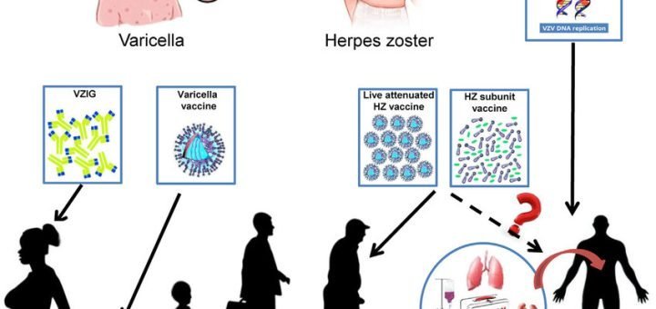 Life cycle of varicella zoster virus