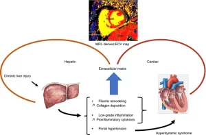 Cardio-Pulmonary problems in Liver Cirrhosis