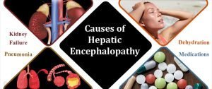Hepatic Encephalopathy 