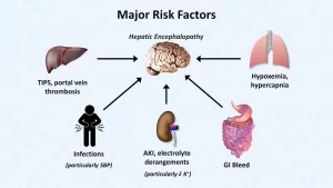 Minimal HE (MHE), minimal hepatic encephalopathy symptoms, diagnosis, test and Treatment Minimal hepatic encephalopathy risks