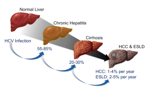 Stages of liver damage