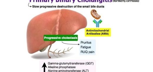 Primary biliary cirrhosis