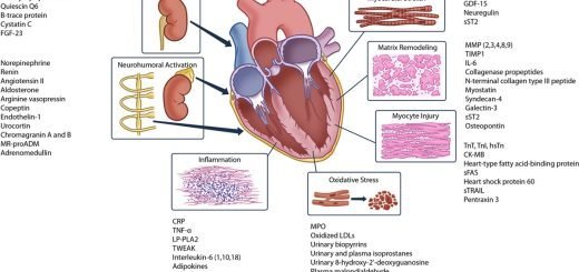 Cardiac Markers review