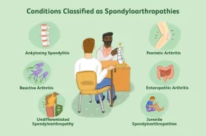 Spondyloarthropathies types