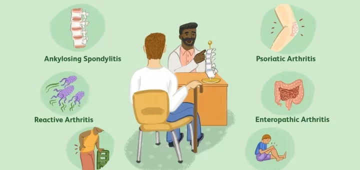 Spondyloarthropathies types