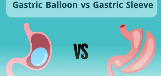 Sleeve gastrectomy vs. intragastric balloon