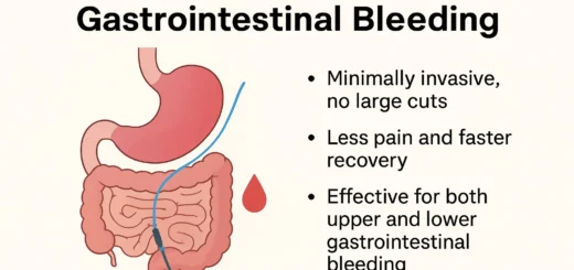 Emergency Bleeding Management | Embolization Techniques