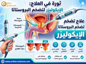 EchoLaser الإيكوليزر لعلاج تضخم البروستاتا 2026: أحدث علاج بدون جراحة مع المميزات والعيوب والتكلفة EchoLaser الإيكوليزر لعلاج تضخم البروستاتا 2026